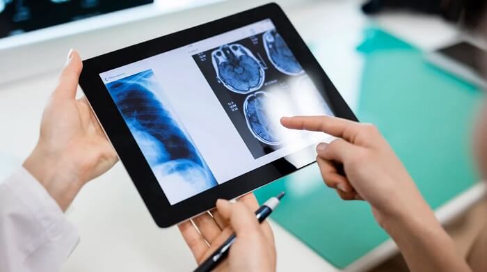 Benefits the patient will have from PACS